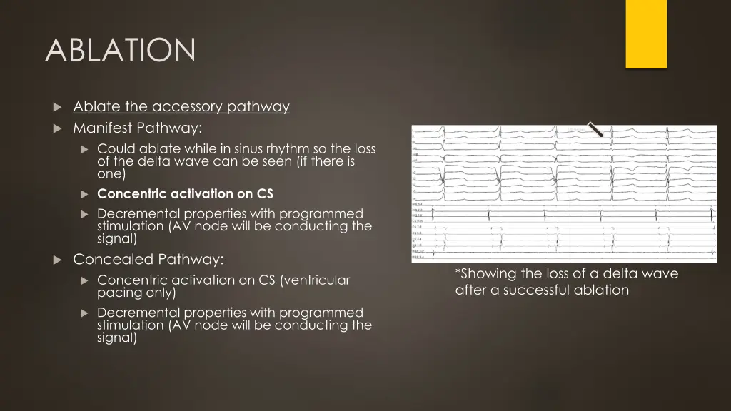 ablation