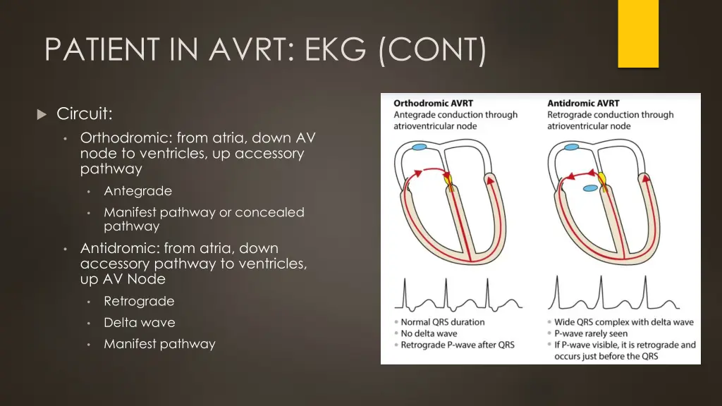 patient in avrt ekg cont