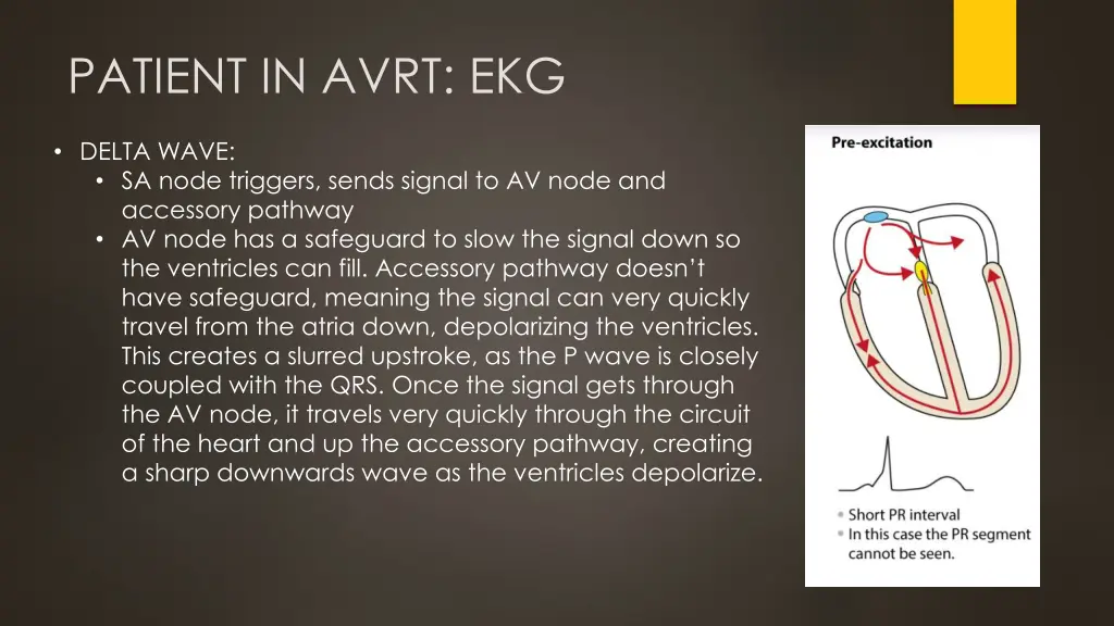 patient in avrt ekg