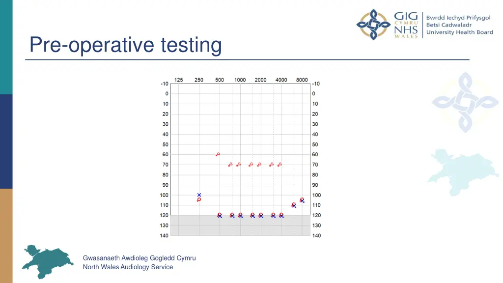 pre operative testing
