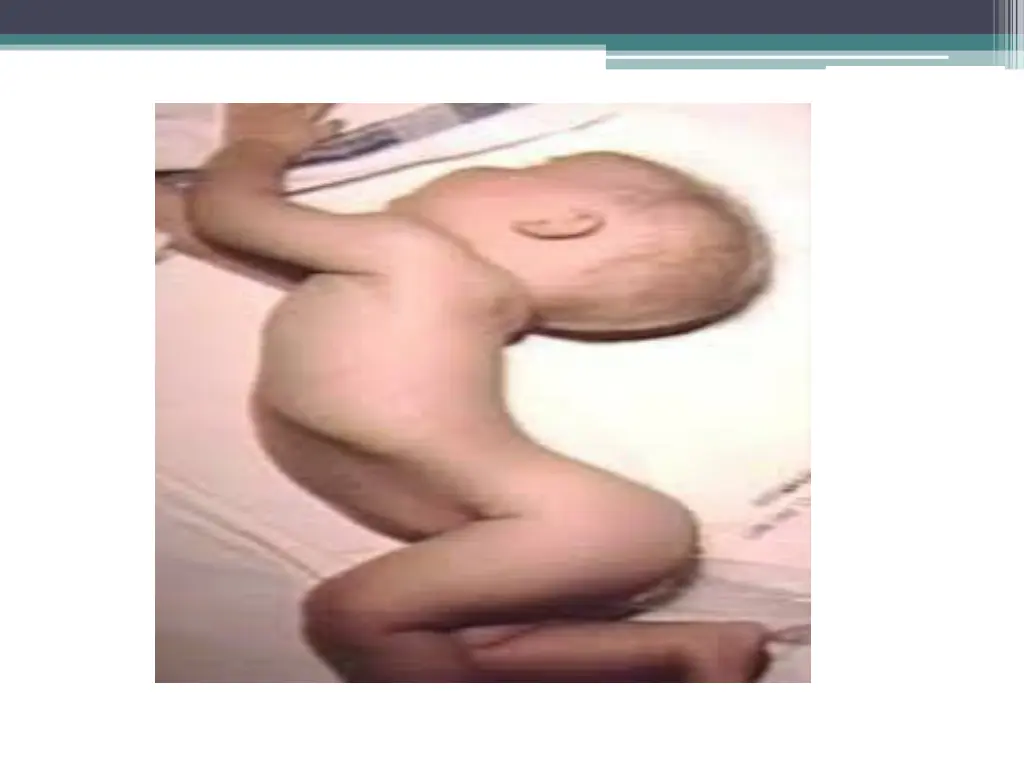 slide24