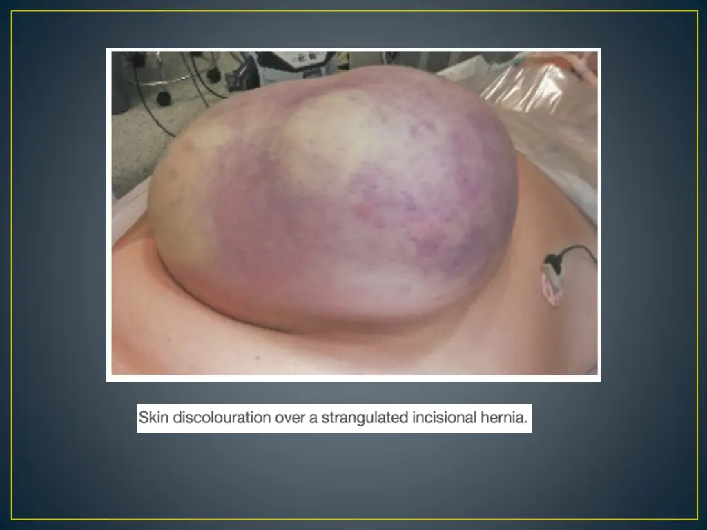 slide11