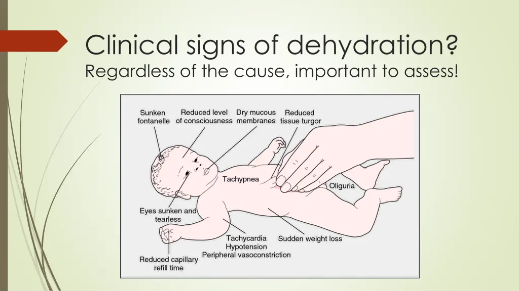 clinical signs of dehydration regardless