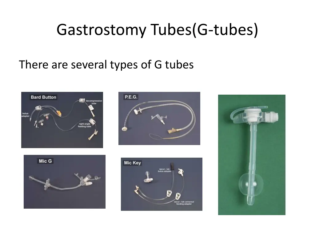 gastrostomy tubes g tubes 1