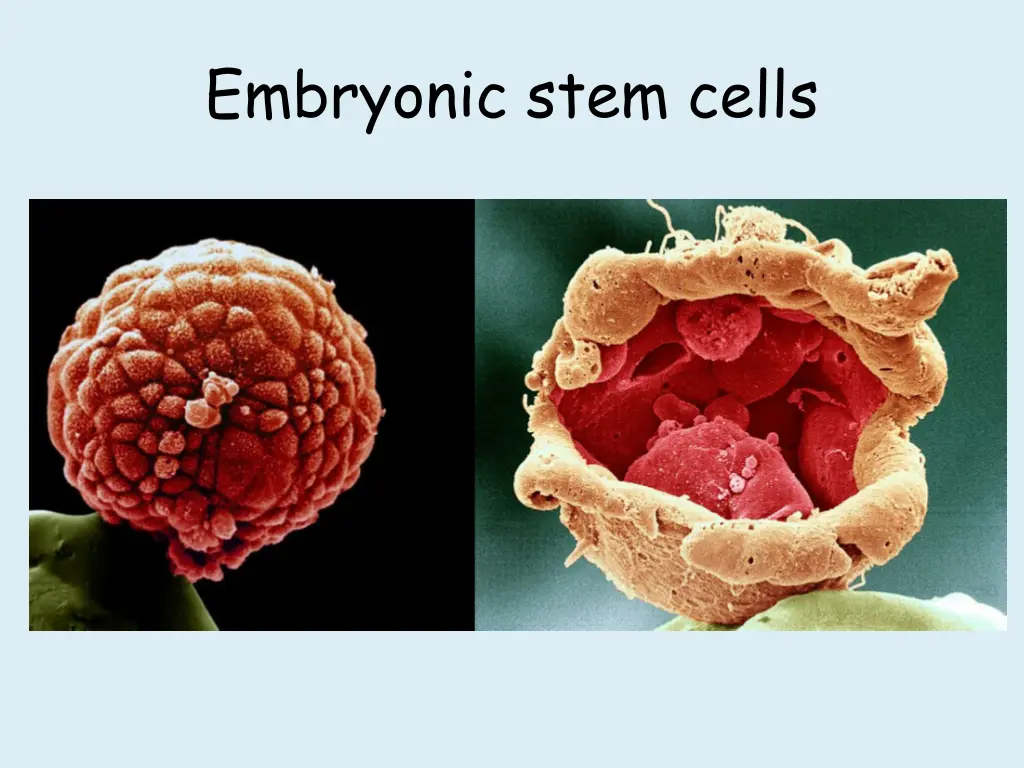 embryonic stem cells