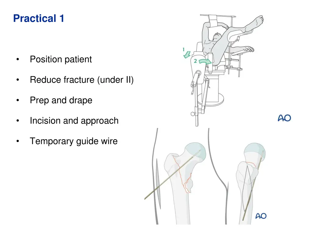 practical 1