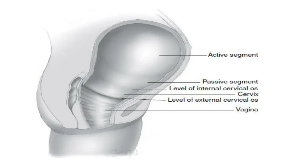 slide13