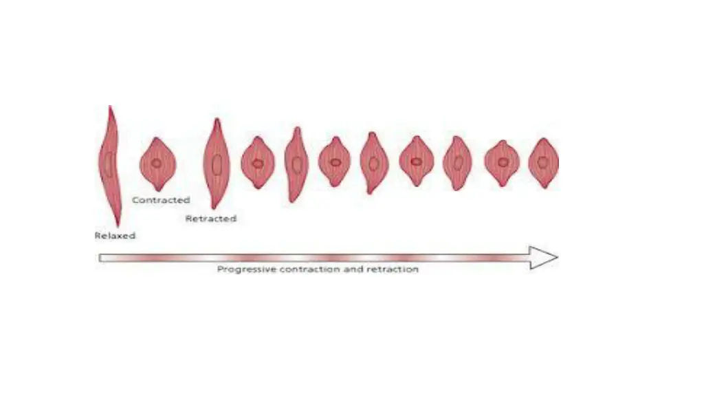 slide18