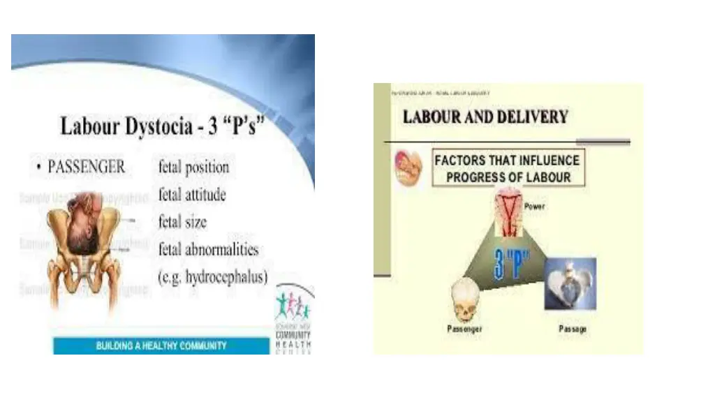 slide5