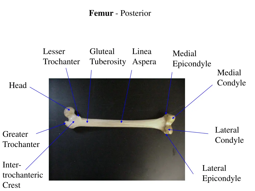 femur posterior