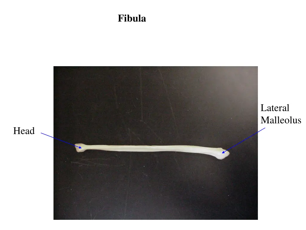 fibula
