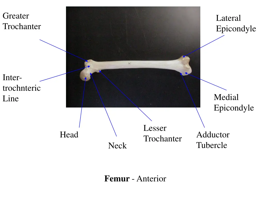 greater trochanter