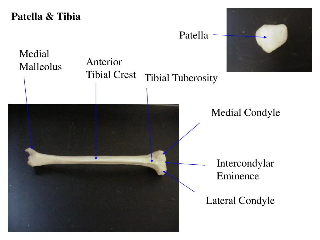 patella tibia