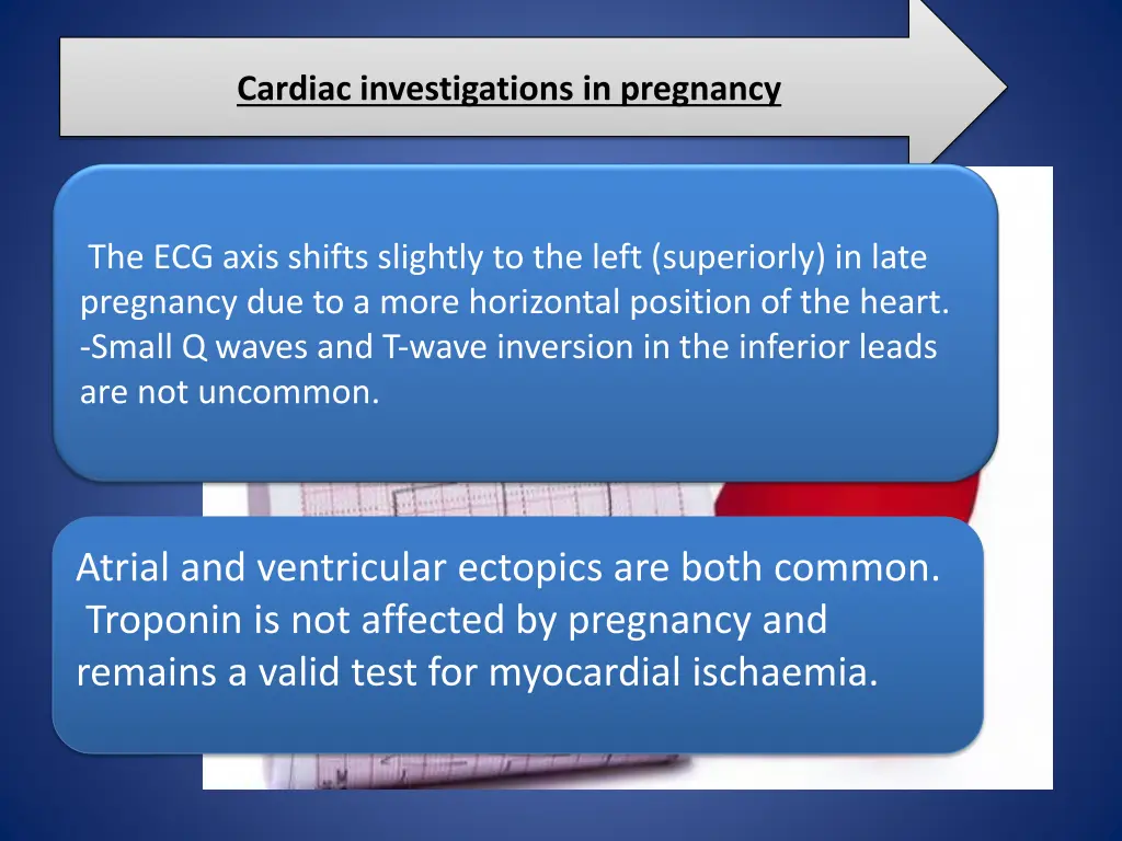 cardiac investigations in pregnancy