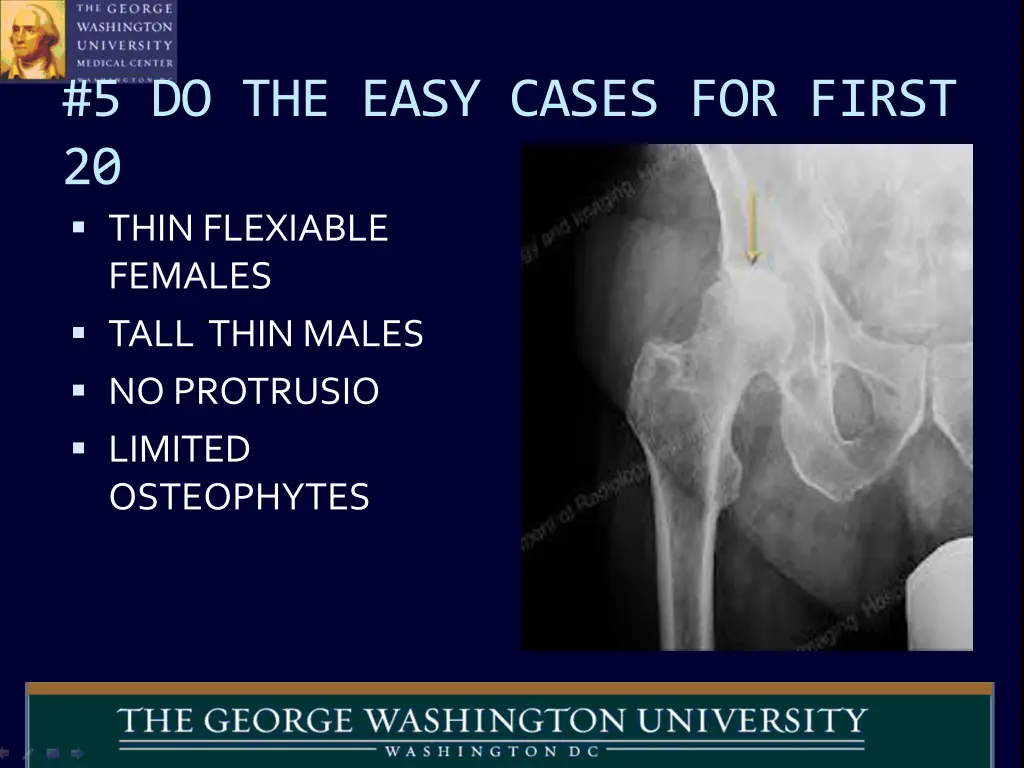5 do the easy cases for first 20 thin flexiable