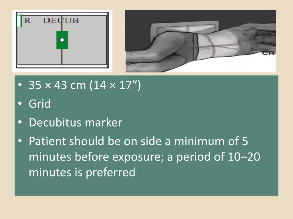 35 43 cm 14 17 grid decubitus marker patient