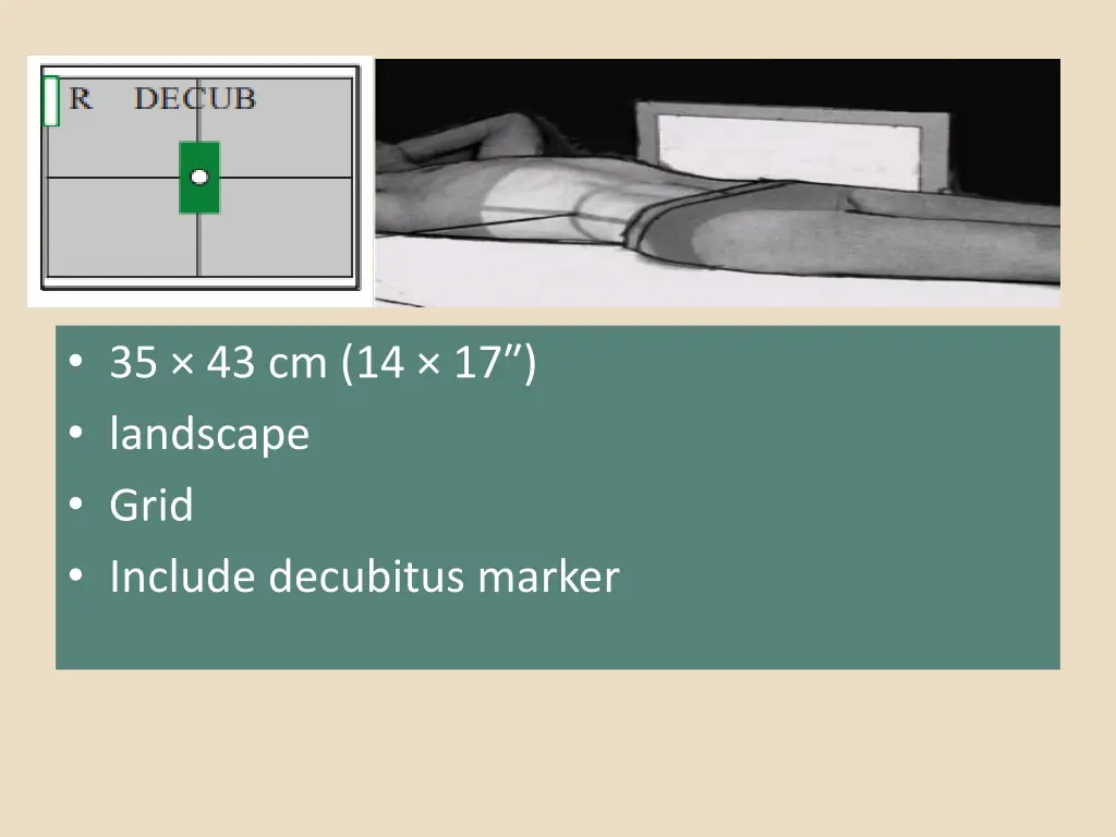 35 43 cm 14 17 landscape grid include decubitus