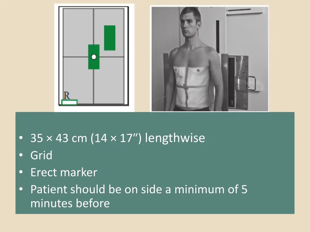 35 43 cm 14 17 lengthwise grid erect marker