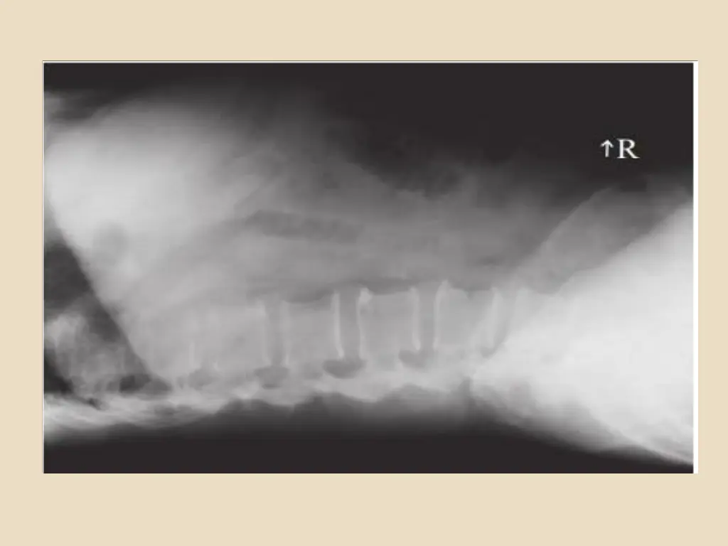 slide17