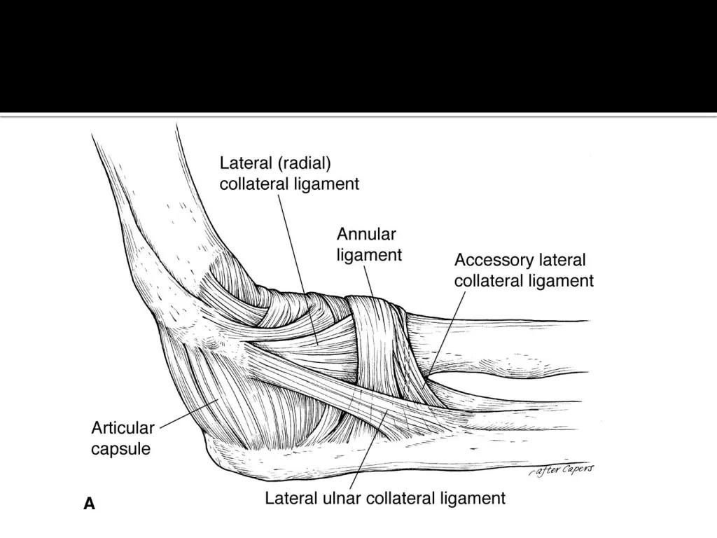slide5