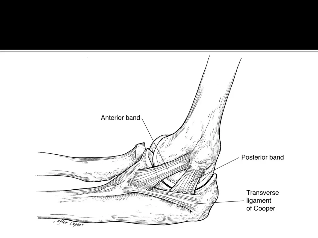slide6