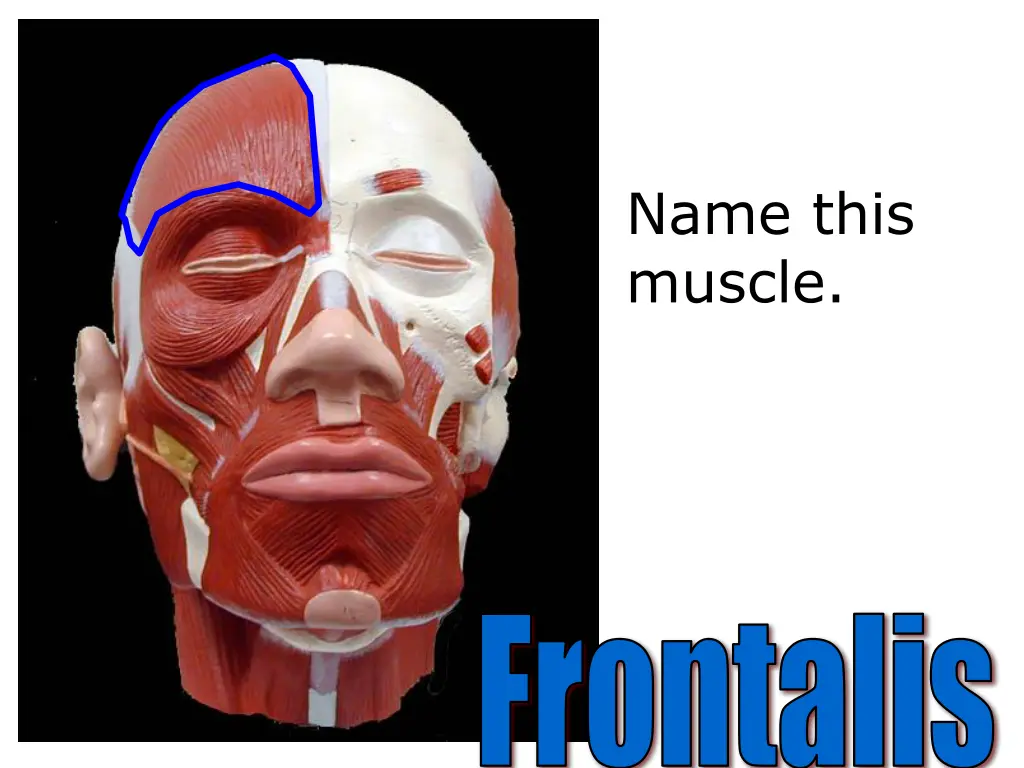 name this muscle 1