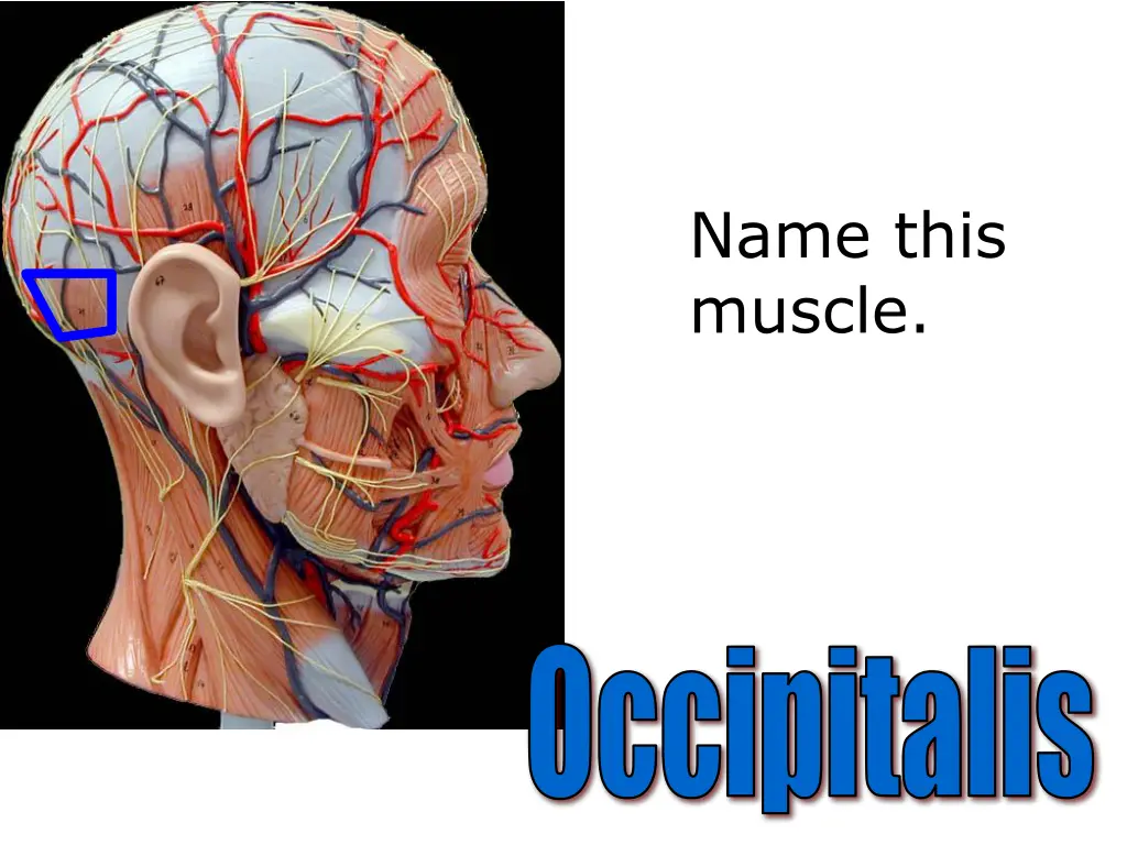 name this muscle 4