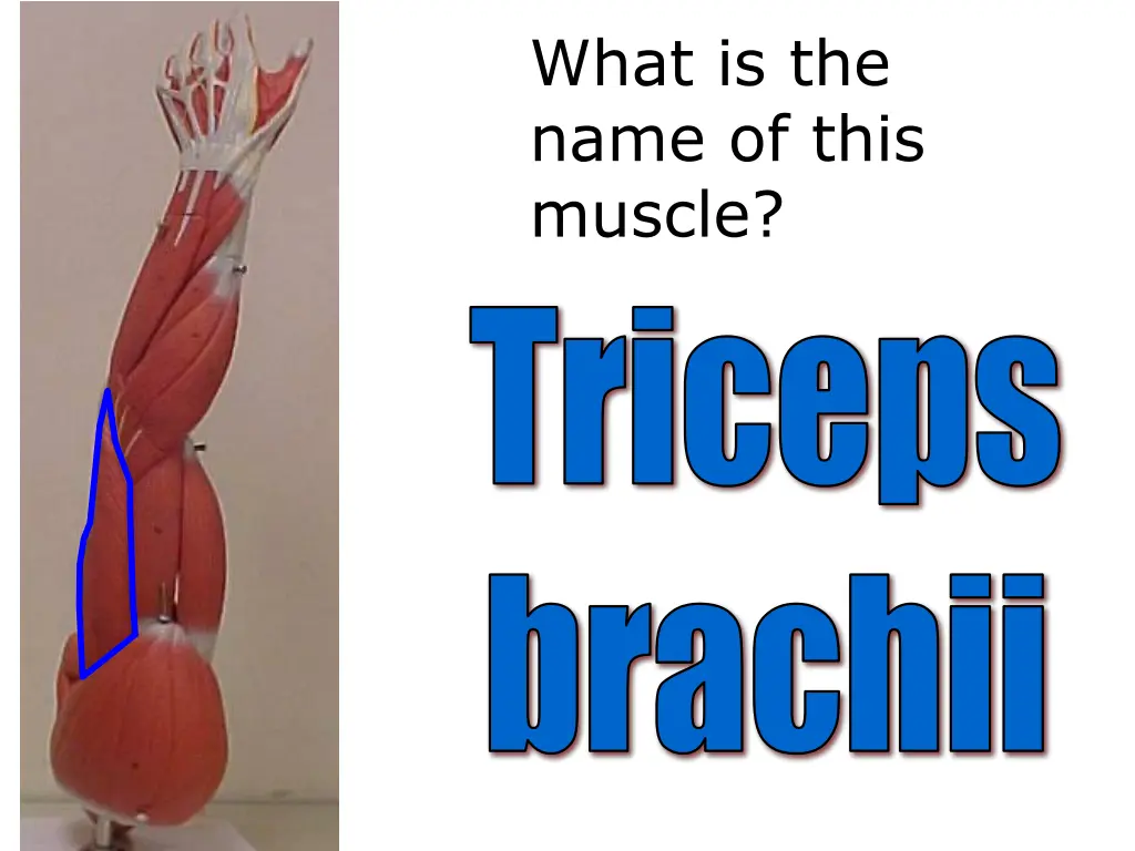 what is the name of this muscle 10