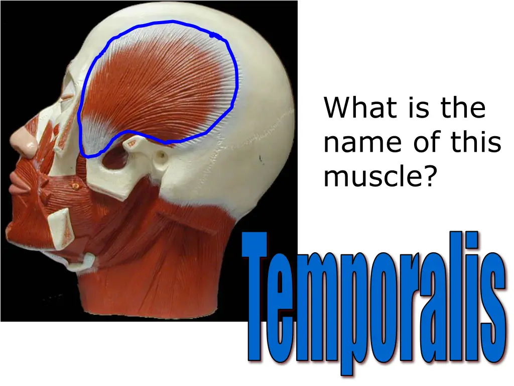 what is the name of this muscle 13