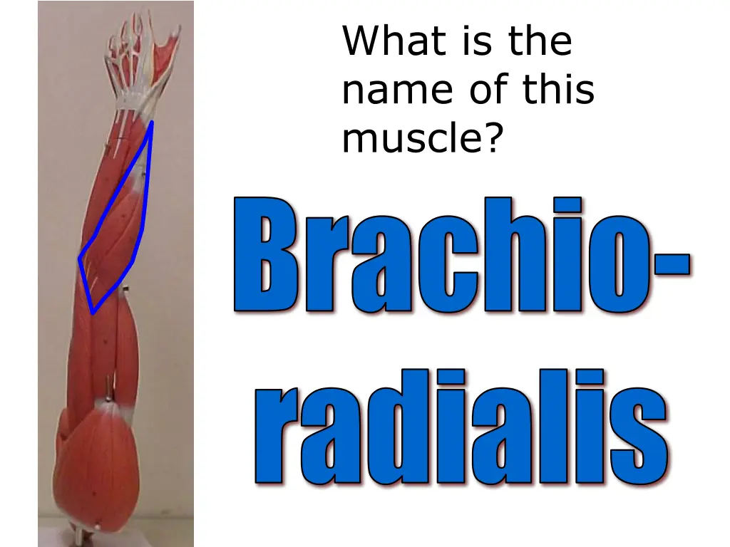 what is the name of this muscle 5