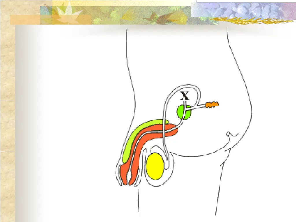 slide15