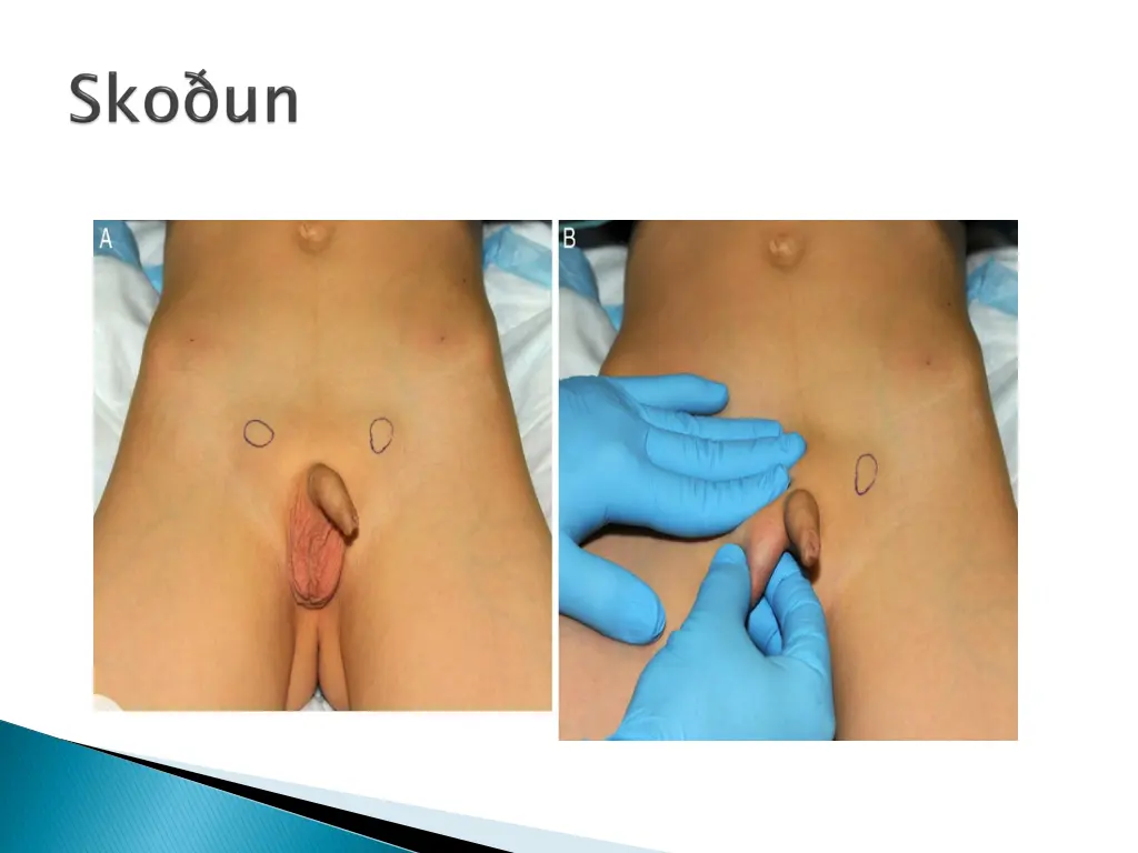slide12