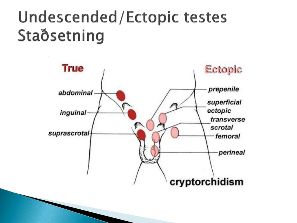 slide7