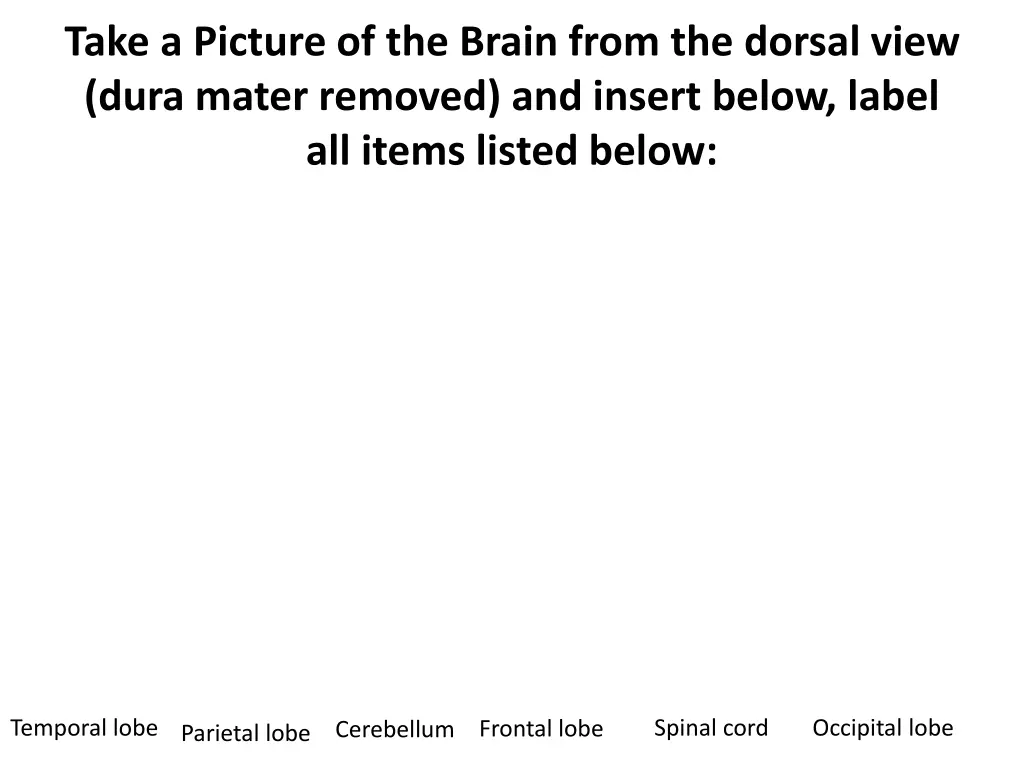 take a picture of the brain from the dorsal view