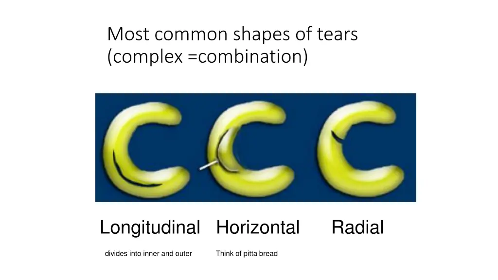 most common shapes of tears complex combination