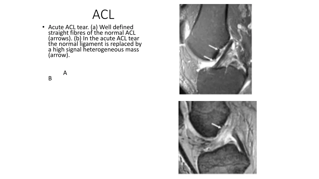 slide13