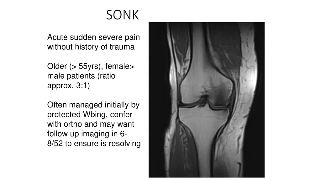 slide25