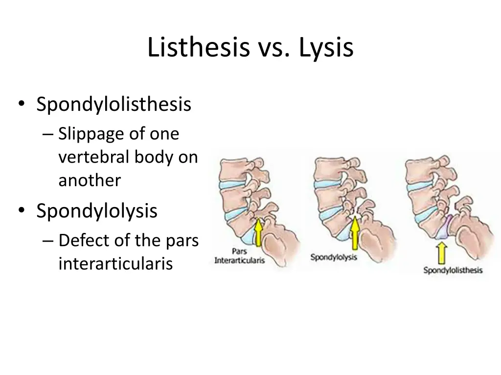 listhesis vs lysis