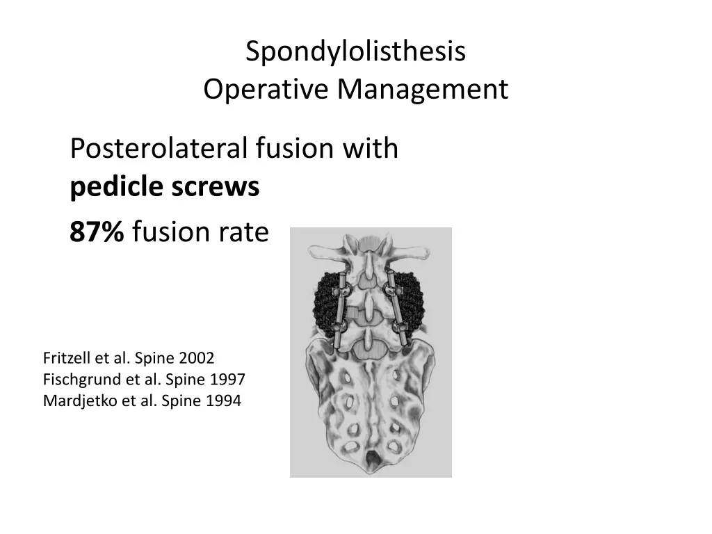 spondylolisthesis operative management 1