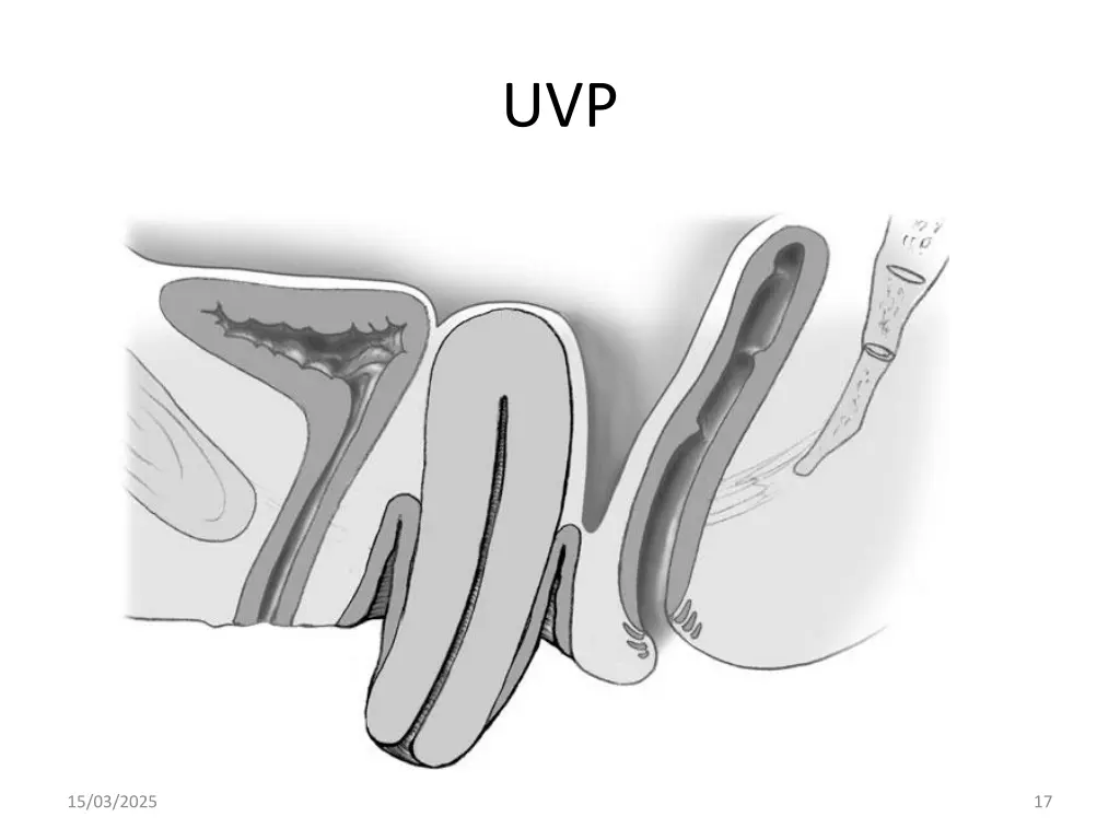 slide17