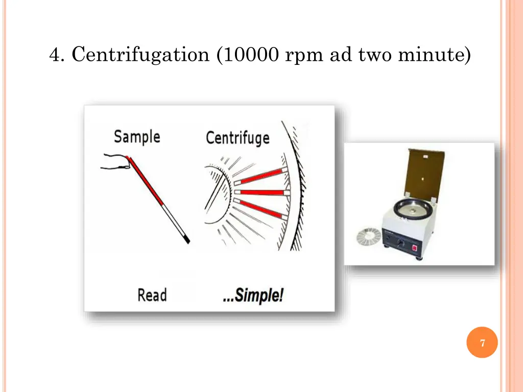 4 centrifugation 10000 rpm ad two minute