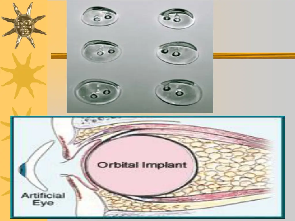 slide13
