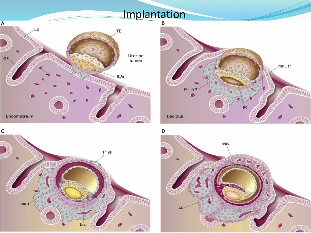 implantation 1
