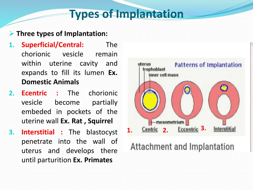types of implantation