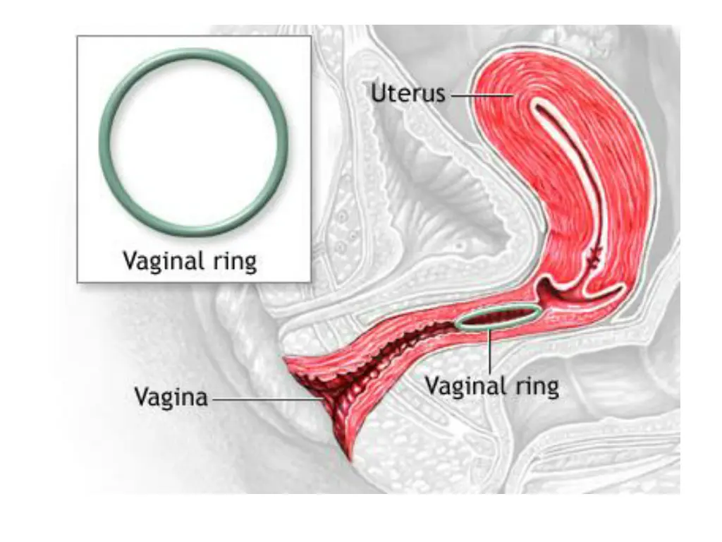 slide29
