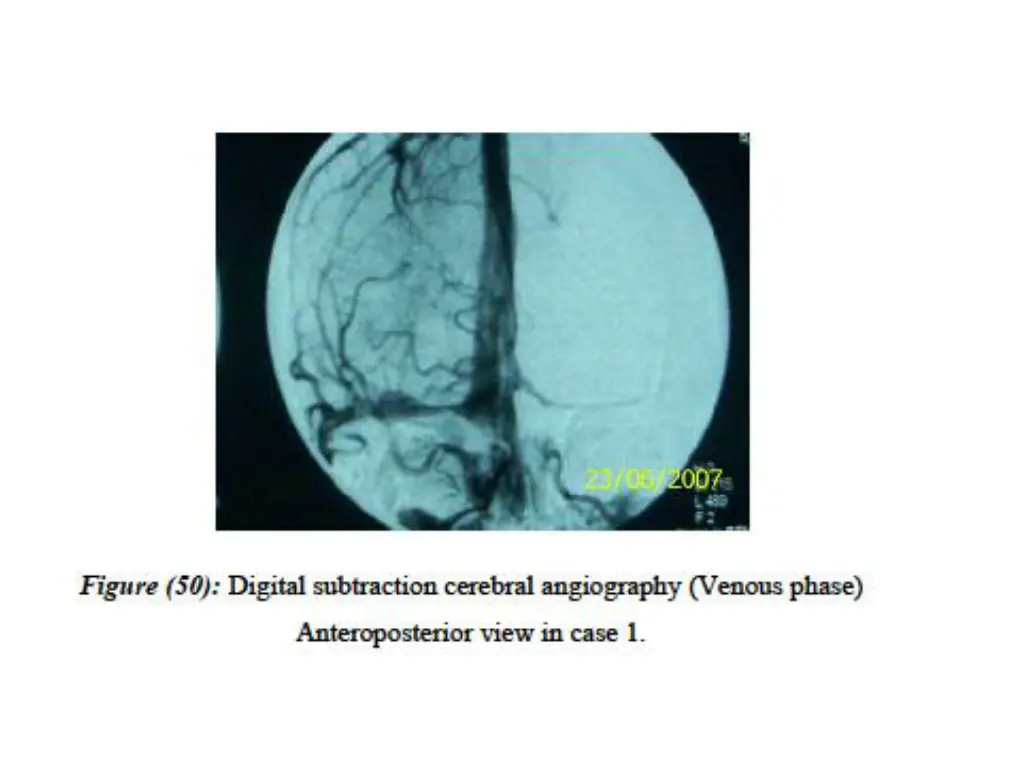 slide18