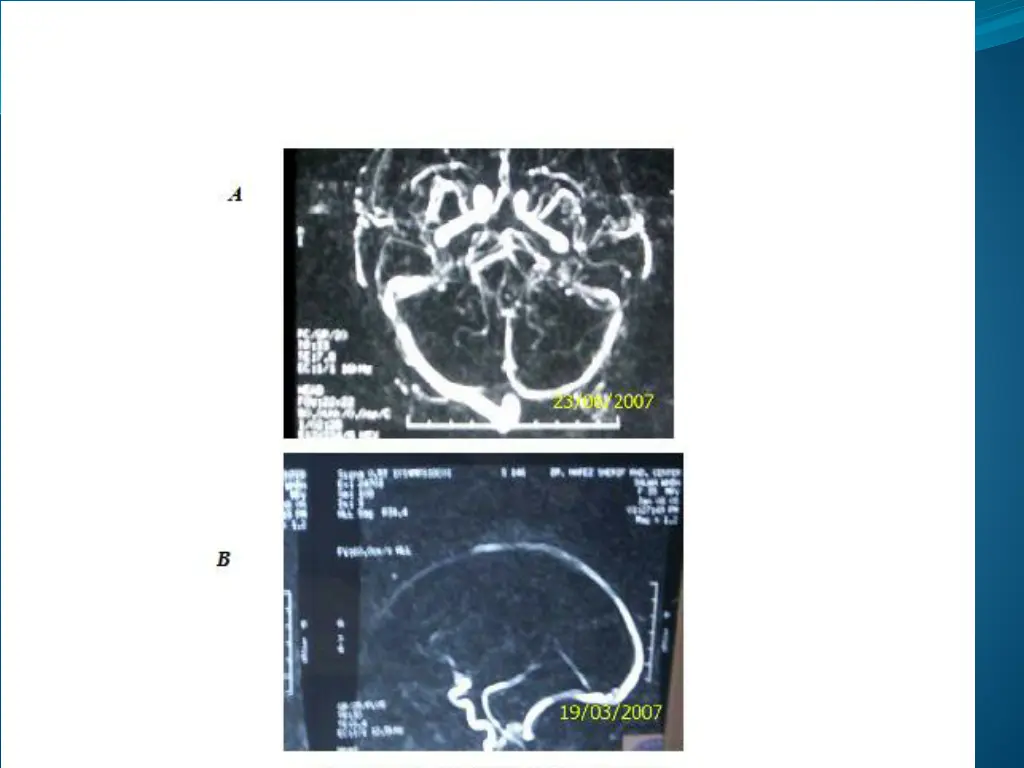 slide19