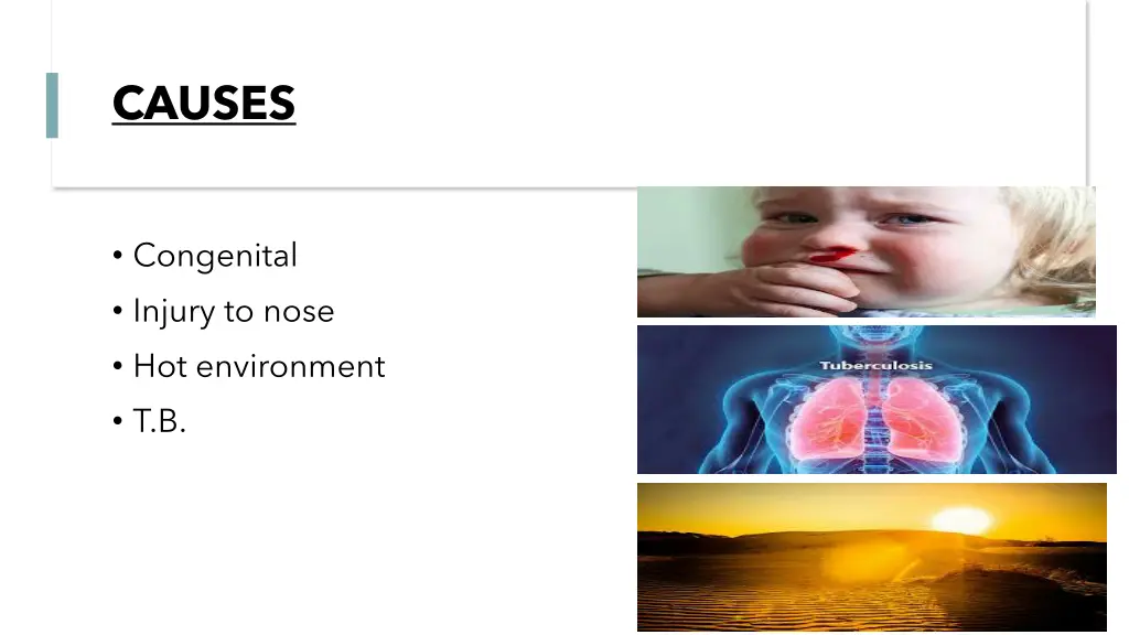 causes