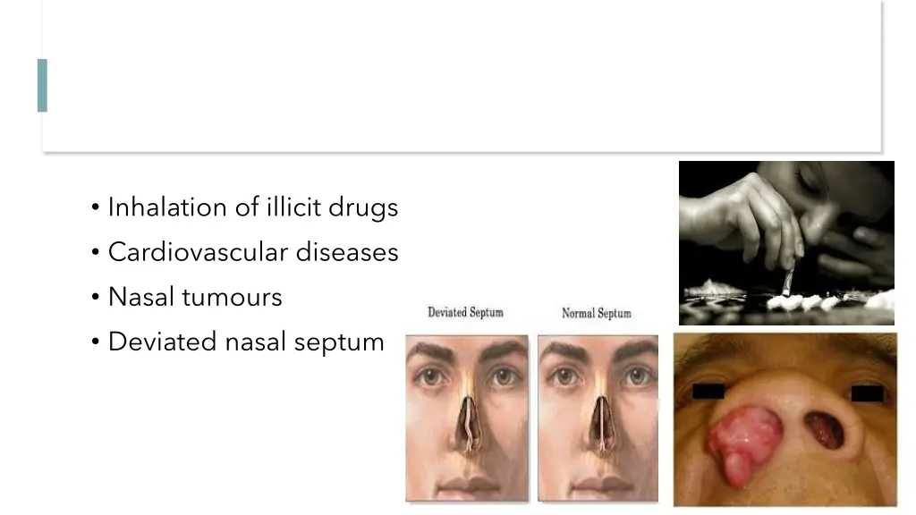 inhalation of illicit drugs cardiovascular