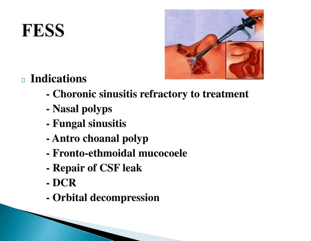 indications choronic sinusitis refractory